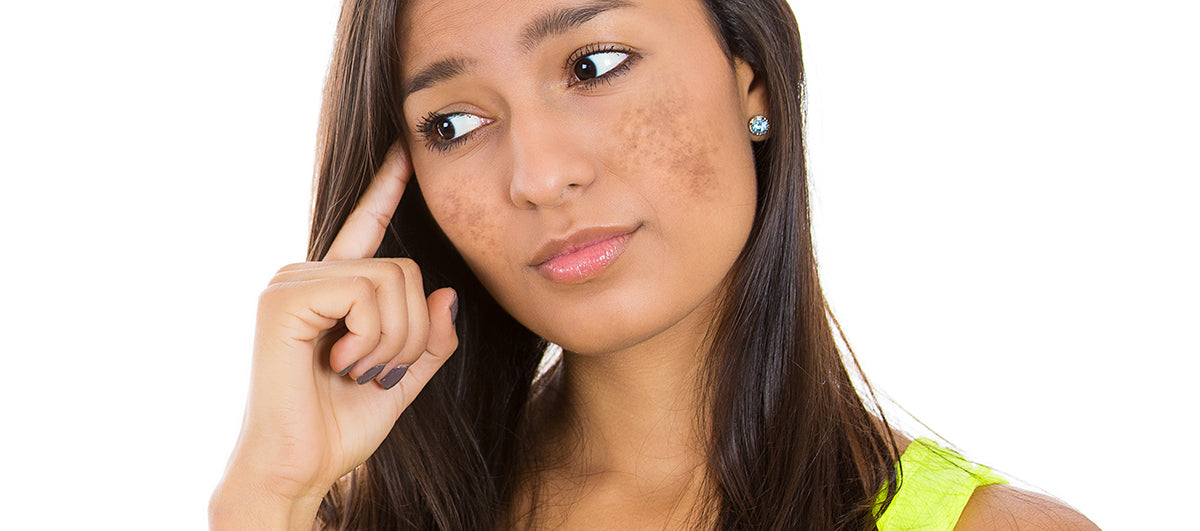 Why am I getting Dark Spots on my face? — GMARO Magazine