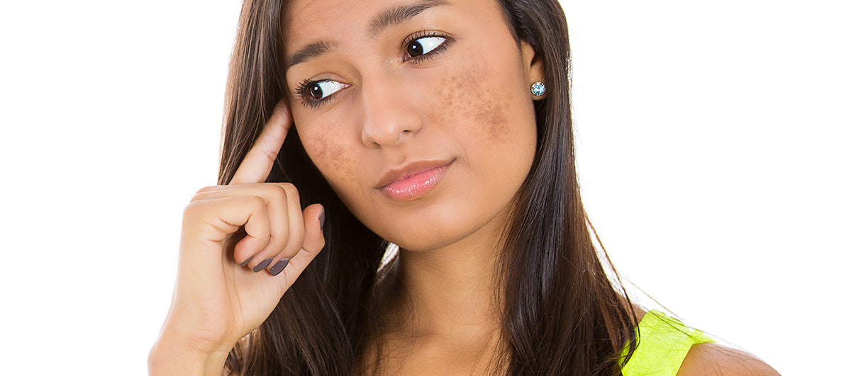 Why am I getting Dark Spots on my face? — GMARO Magazine, Fashion, Beauty