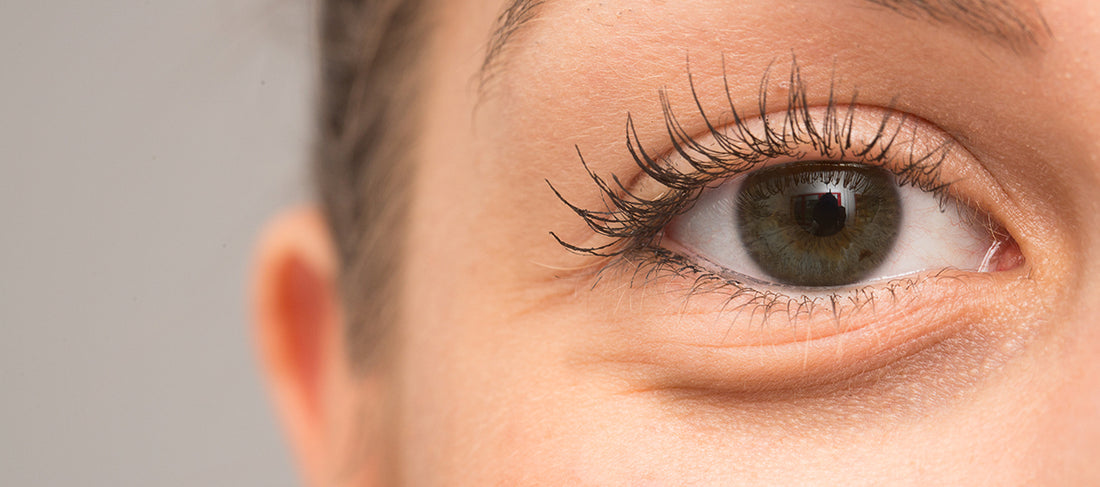 Struggling with Puffy Eyes? Evaluate and Try This to Help