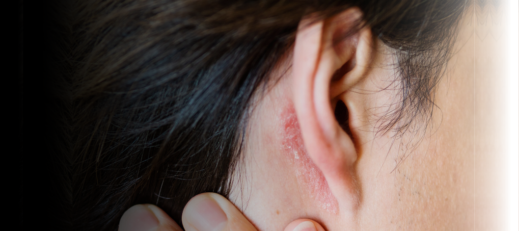 Dry skin behind your ears? 8 effective ways to treat it