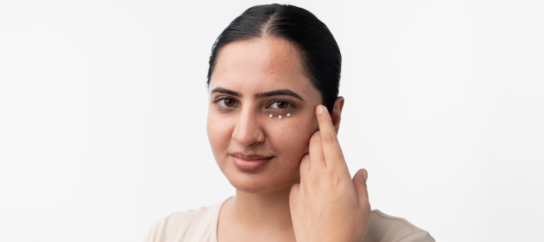 5 Quickest Ways To Get Rid Of Sunken Eyes